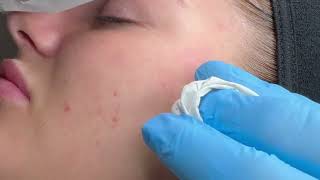 SkinViva  Skin Therapist Jules Talks Deep Cleanse Facial [upl. by Odilo77]