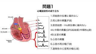 【心電図勉強会】4問目 [upl. by Suzi27]