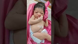 Newborn baby with a big caput due to obstructed labour📽️shortsshortsfeedshortvideotrendingbaby [upl. by Sailesh910]