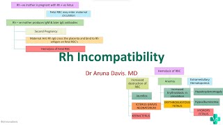 Rh Incompatibility HEMOLYTIC DISEASE OF NEWBORN Erythroblastosis Fetalis [upl. by Nailliw]