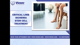 Critical Limb Ischemia Treatment  Best Stem Cell Hospital For Critical Limb Ischemia  Exosome [upl. by Akenat117]