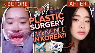 FOODTALES MUCKBANG YOUTUBERs two jaw  vline surgery experience at ID hospital Korea part 1 [upl. by Horatius]