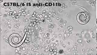 The JI  AntibodyMediated Trapping of Helminth Larvae Requires CD11b and Fcγ Receptor I [upl. by Perrins802]