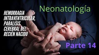 Hemorragia Intraventricular Paralisis Cerebral del Recién Nacido  Neonatología [upl. by Boothman27]