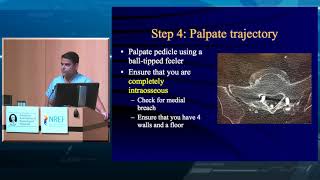 Lumbar Pedicle Screw Placement [upl. by Ykciv]