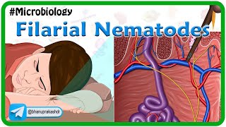 Filarial nematodes Animation🐛 Wuchereria onchocera volvulus LoaLoa Dracunculus Trichinella [upl. by Andrade]