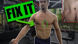 My Favourite Exercise for Pectus Excavatum [upl. by Inwat]