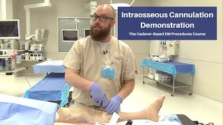 Intraosseous Cannulation Demonstration  The CadaverBased EM Procedures SelfStudy Course [upl. by Annoyed]