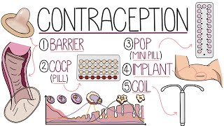 Methods of Contraception Made Easy Contraceptive Methods Explained [upl. by Ahtelrac859]