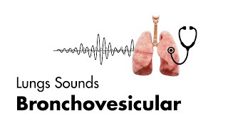 Bronchovesicular Breath Sounds  Lung Sounds  MEDZCOOL [upl. by Fang]