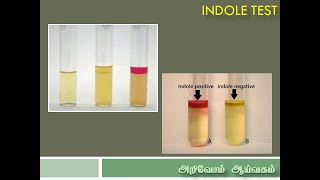 Indole Test in Tamil [upl. by Brenden716]