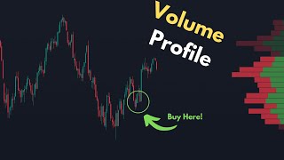 The Best Volume Profile Trading Strategy  Technical Analysis [upl. by Livesay]