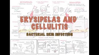 Bacterial Skin Infection  Cellulitis and Erysipelas Clinical Presentation Pathology Treatment [upl. by Eceirehs]