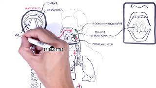 Stridor in children causes inspiratory and expiratory stridor pathophysiology [upl. by Yenaj114]