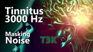 Tinnitus T3K 3000 Hz Noise Masking Might Relieve Your Ringing [upl. by Artus]