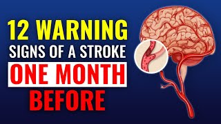 These 12 Warning Signs of a Stroke 1 Month Before DONT IGNORE Them [upl. by Yonita]