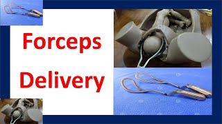 Forceps Delivery  Forceps Assisted Delivery  Delivery with Forceps [upl. by Ainatit]