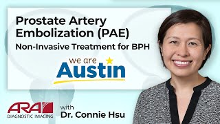 Prostate Artery Embolization  A NonInvasive Treatment for BPH  ARA Diagnostic Imaging [upl. by Reta]