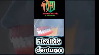 Flexible dentures short viral  tiktok challenge tiktok dental [upl. by Aihsiyt]