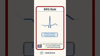 EKG Quiz EKG Pflege kardiologie [upl. by Lise219]