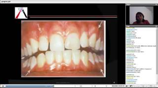 Periodontics  Gingiva and Tooth Supporting Structure [upl. by Shani609]