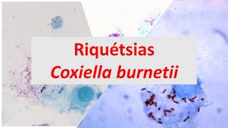 Microbiologia Médica Riquétsias e Coxiella burnetti [upl. by Wilkins]