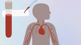 COVID19 animation Coronavirus and antibody testing explained [upl. by Llemhar]