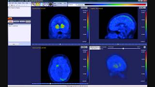 How to use View mode in Carimas 20 [upl. by Ecirtel]