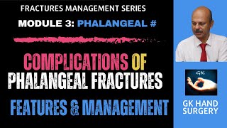 Complications of phalangeal fractures Features of malunion malrotation and osteotomy management [upl. by Ethan]