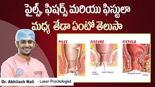 Difference Between Piles Fissures and Fistula In Telugu  Health Facts  Dr Abhilash Nali [upl. by Brackely242]