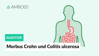 Morbus Crohn und Colitis ulcerosa  Worin unterscheiden sie sich  AMBOSS Auditor [upl. by Hamo266]