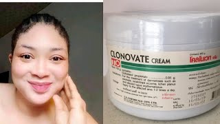 Clonovate cream [upl. by Noseyt]