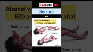 Nontypical Seizures [upl. by Aned]