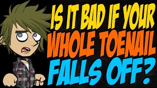 Is it Bad if Your Whole Toenail Falls Off [upl. by Kuster573]