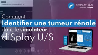 Comment identifier une tumeur rénale dans le simulateur déchographie diSplay US [upl. by Enelad]