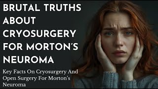 Here are some direct straightforward facts about cryosurgery for Mortons Neuroma [upl. by Gromme]