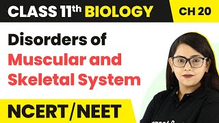 Disorders of Muscular amp Skeletal System  Locomotion amp Movement  Class 11 Biology Ch 20 NCERTNEET [upl. by Georgiana644]