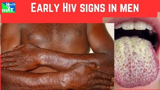 EARLY HIV SIGNS IN MEN [upl. by Map588]