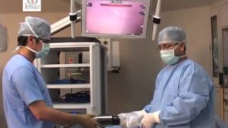 Basics of Robotic Surgery Da Vinci Si HD Surgical System Instructional Video [upl. by Ephrem6]