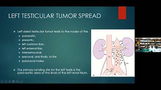 Retroperitoneal Lymph Node Dissection RPLND [upl. by Eggleston]