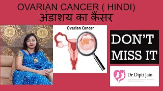 OVARIAN CANCER  HINDI अंडाशय का कैंसर DONT MISS IT [upl. by Yssis330]