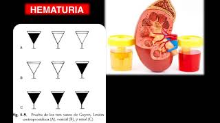 27 RENAL  Hematuria disuria enuresis oliguria [upl. by Enyar]