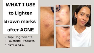 BEST Ingredients and PRODUCTS to LIGHTEN brown pigmentation AFTER ACNE  Acne Marks [upl. by Havener]