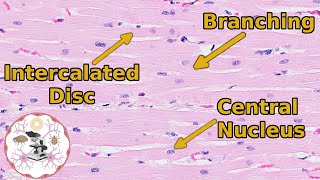 Heart Histology  Valveuable Insights [upl. by Dihahs630]