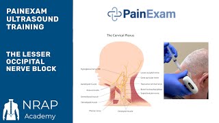 The Ultrasound Guided Lesser Occipital Nerve Block NRAP Academys Ultrasound Course excerpt [upl. by Wisnicki740]