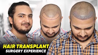 Hair Transplant in Muzaffarnagar  Best Results amp Cost of Hair Transplant in Muzaffarnagar [upl. by Brigham]