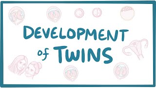 Development of twins [upl. by Yahsel]