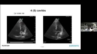 Webinaire Echographie thoracique en Anesthésie [upl. by Lemar]