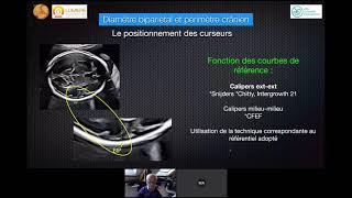 BIOMÉTRIE FOETALE BIEN MESURER  ÉCHOGRAPHIE OBSTÉTRICALE [upl. by Schnur708]