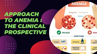 Approach to Anemia  The clinical Prospective [upl. by Navad]